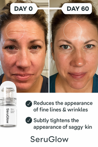 SeruGlo MicroFusion System