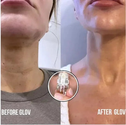 SeruGlo MicroFusion System